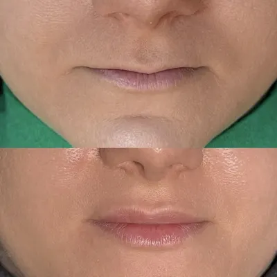 NISHA CLINIC - kosmetologia i medycyna estetyczna